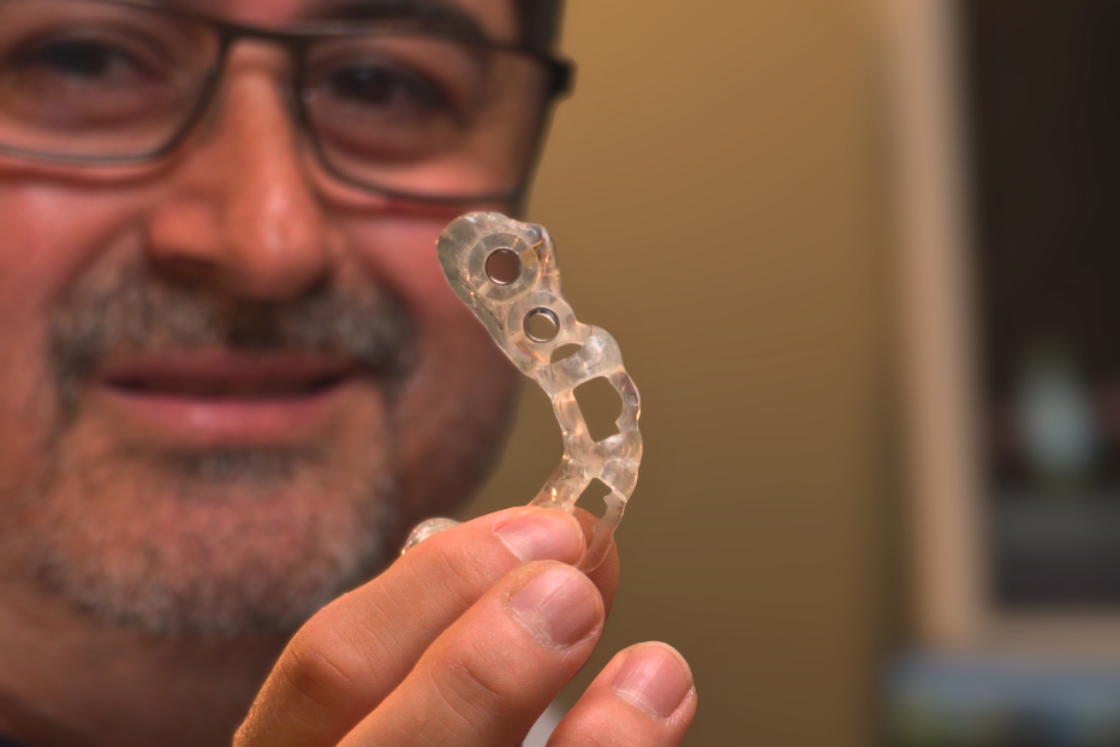 fully guided dental implants