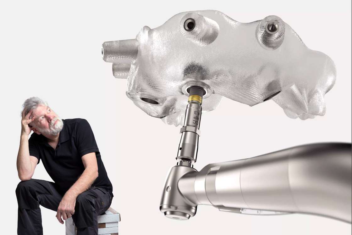 How Long Do Dental Implants Really Last?